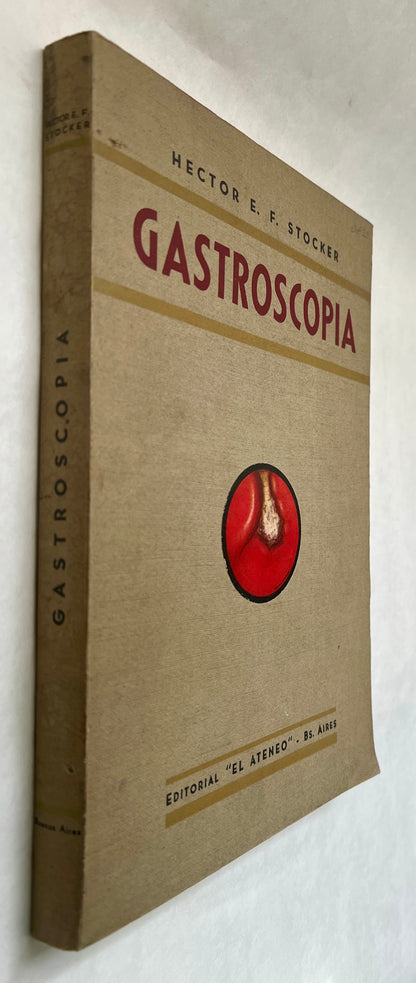 Gastroscopia