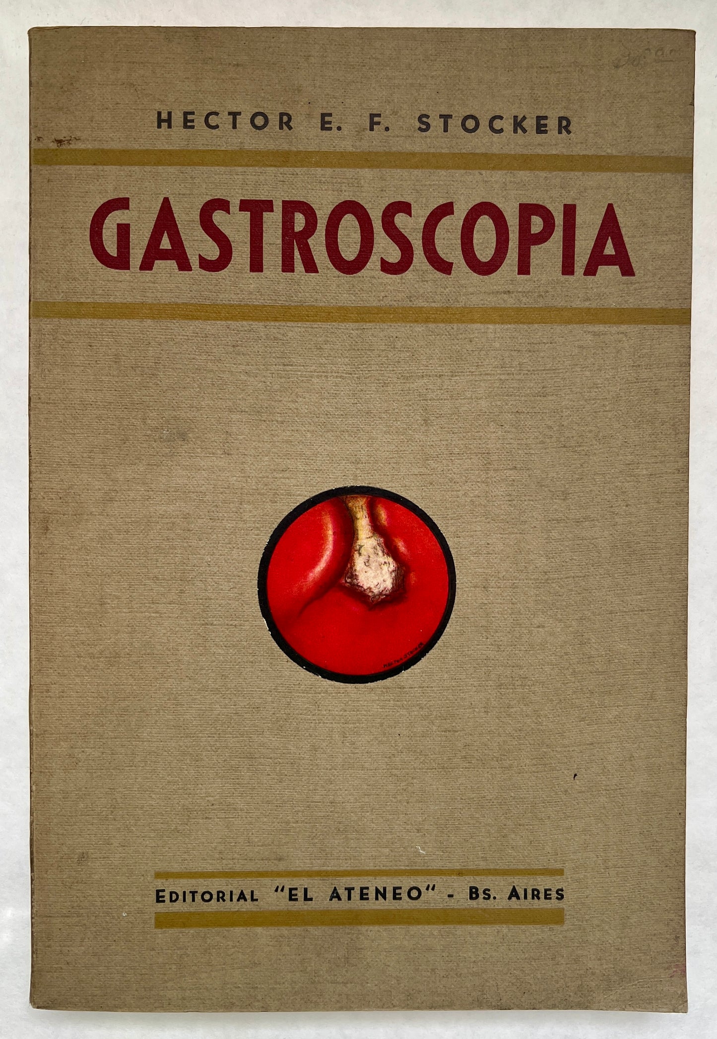 Gastroscopia