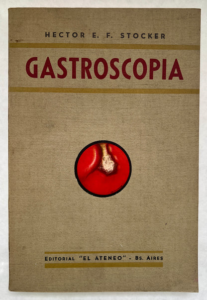 Gastroscopia